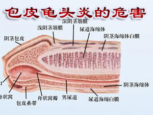 龟头瘙痒是怎么回事